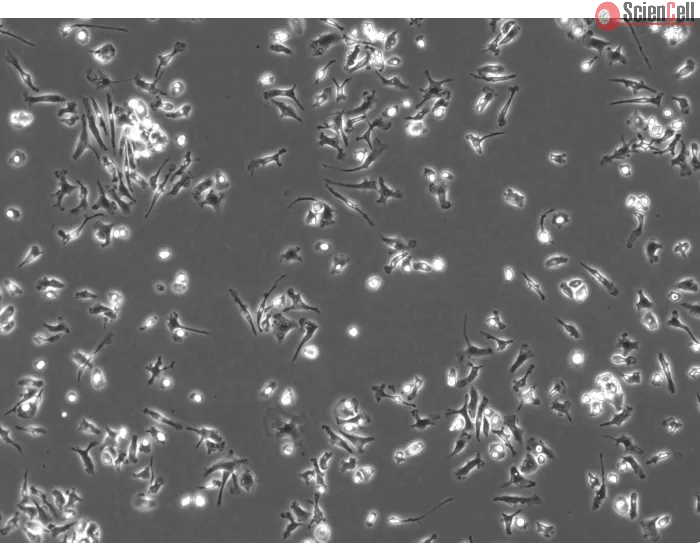 Mouse Pulmonary Alveolar Macrophages (MPAMa) - Phase contrast, 100x
