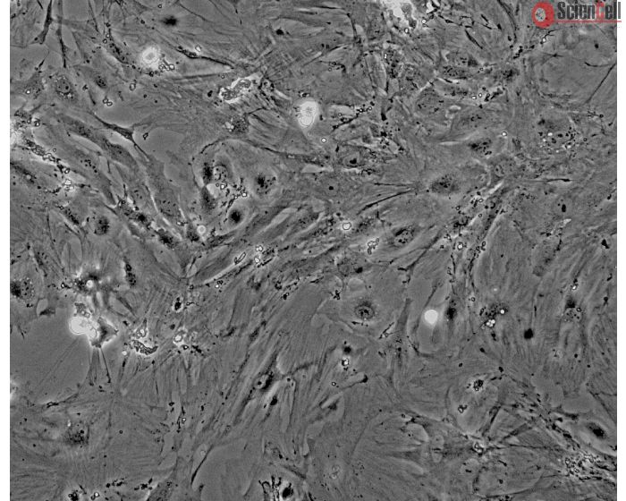 Mouse Renal Mesangial Cells (MRMC) - Phase contrast