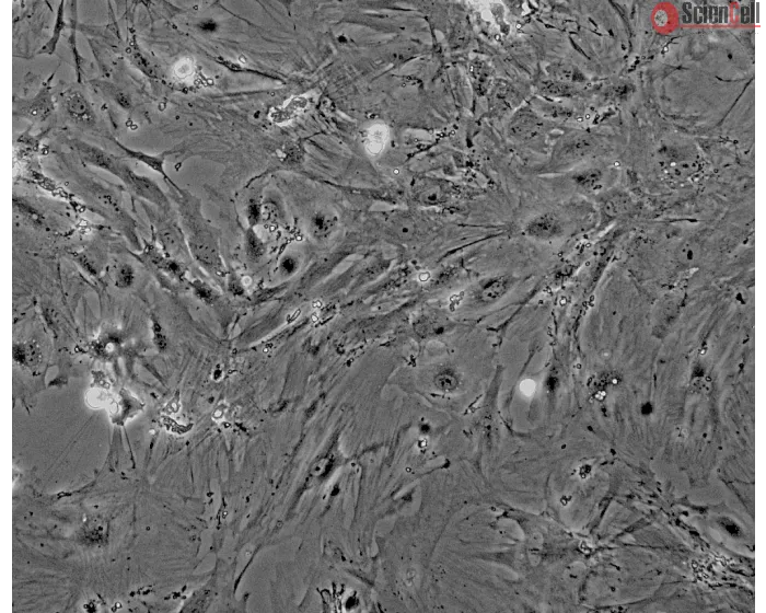 Mouse Renal Mesangial Cells (MRMC) - Phase contrast, 100x.
