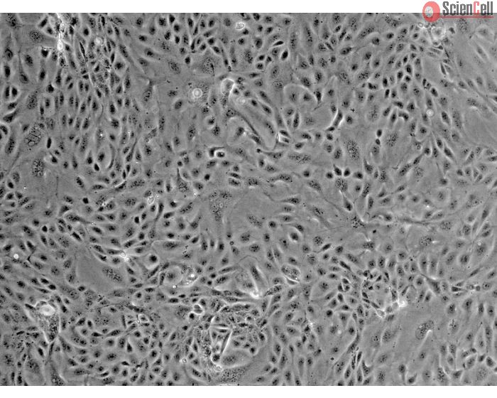Mouse Renal Proximal Tubular Epithelial Cells (MRPTEpiC) - Phase contrast, 100x.
