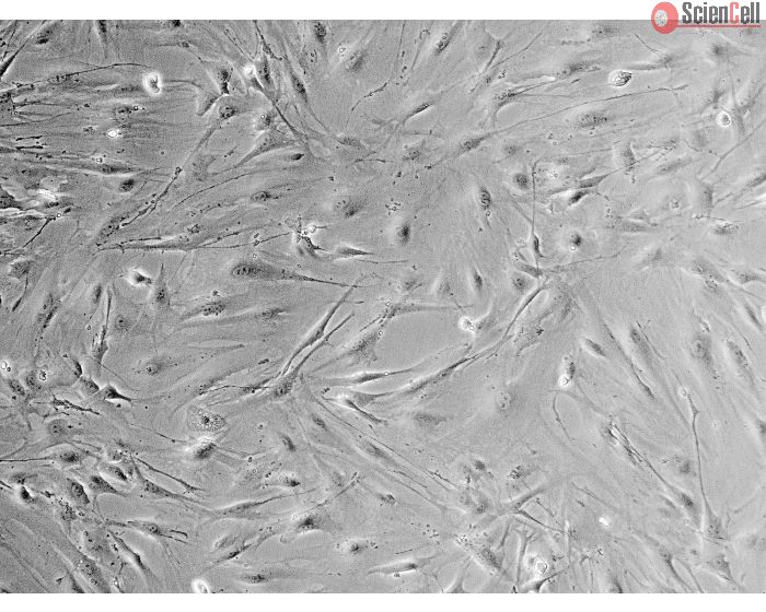 Mouse Salivary Gland Fibroblasts (MSGF) - Phase contrast