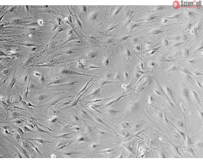 Mouse Salivary Gland Fibroblasts (MSGF) - Phase contrast, 100x.
