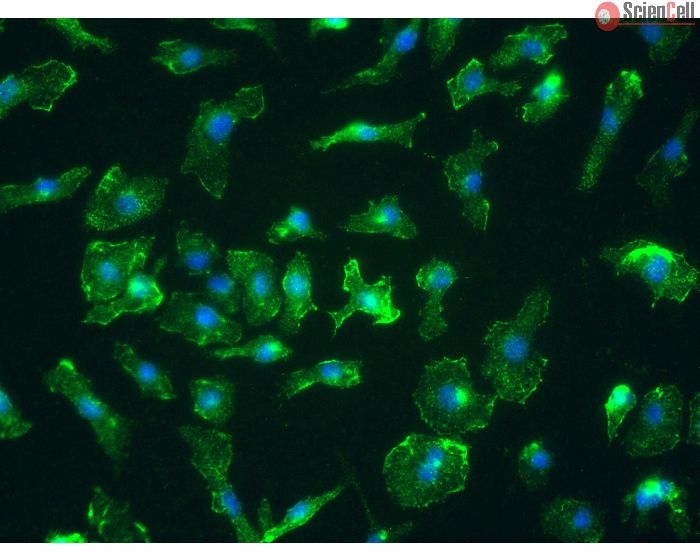 Mouse Splenic Macrophages (MSMa) - Immunostaining for CD11b