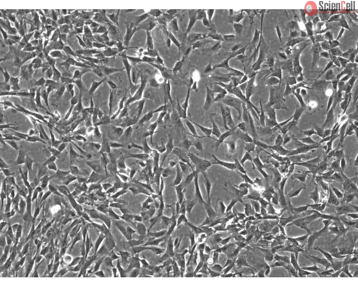 Rabbit Astrocytes (RabA) – Phase Contrast, 100X.
