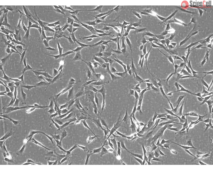 Rabbit Cardiac Fibroblasts (RabCF) – Phase Contrast, 100X.