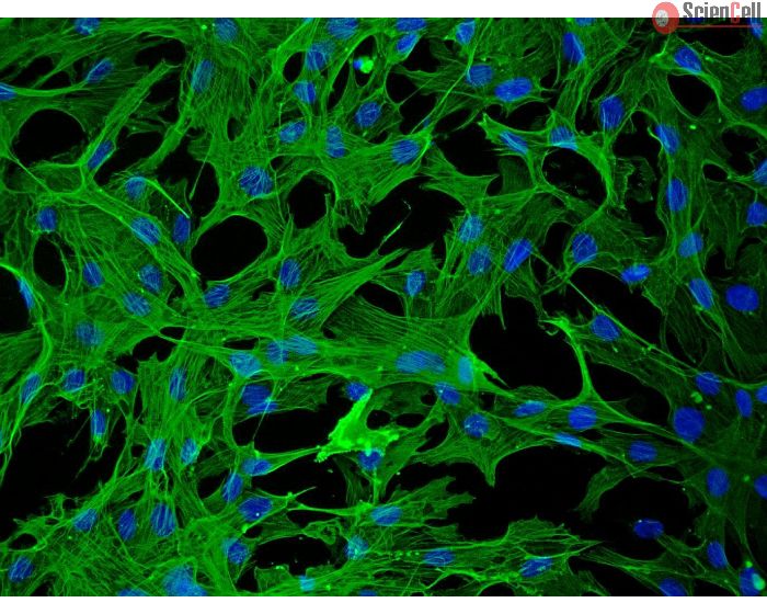 Rabbit Hepatic Stellate Cells (RabHSteC) – Immunostaining for alpha-smooth muscle actin