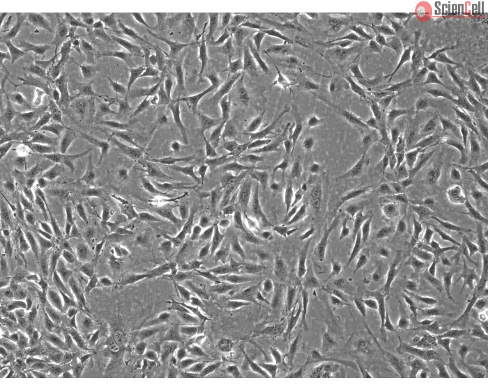 Rabbit Renal Mesangial Cells (RabRMC) – Phase Contrast, 100X.
