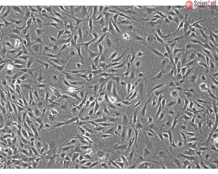 Rabbit Renal Mesangial Cells (RabRMC) – Immunostaining for FN