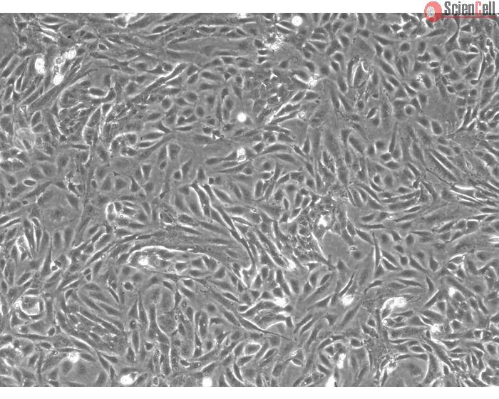 Rabbit Renal Proximal Tubule Epithelial Cells (RabRPTEpiC) – Phase Contrast, 100X.
