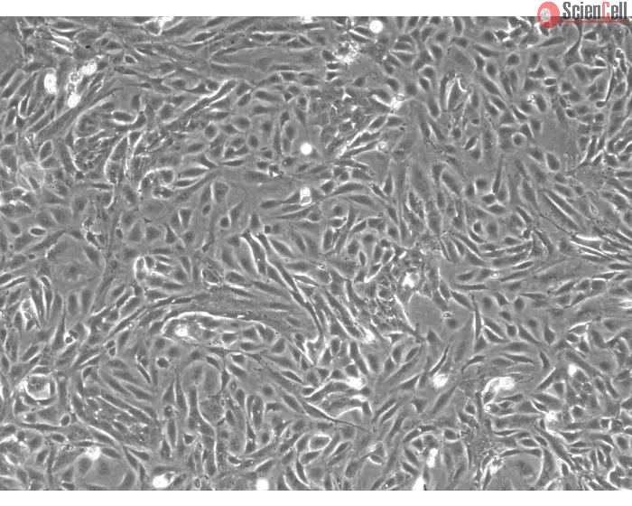 Rabbit Renal Proximal Tubule Epithelial Cells (RabRPTEpiC) – Phase Contrast, 100X.
