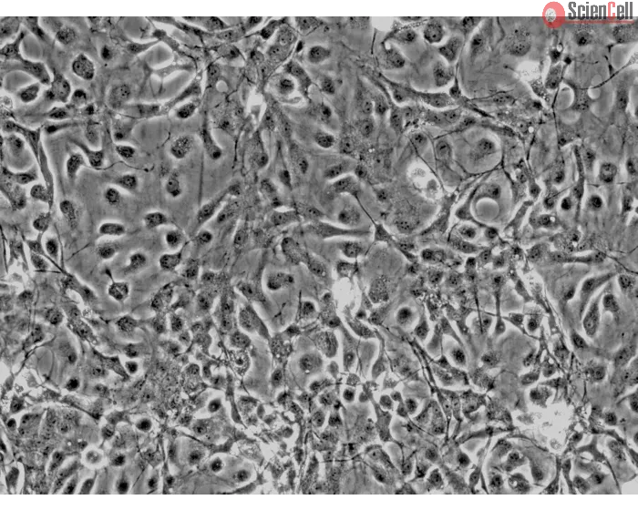 Rat Astrocytes-cerebellar (RA-c) - Phase contrast, 200x.
