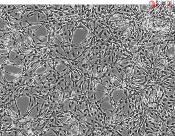 Rat Astrocytes (RA) - Phase contrast