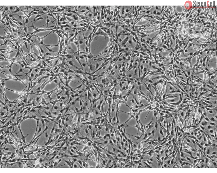 Rat Astrocytes (RA) - Phase contrast, 100x.
