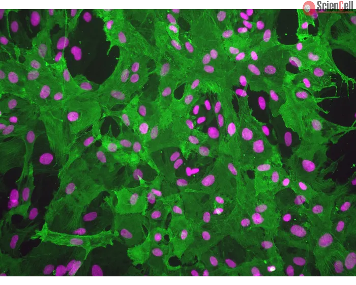 Rat Brain Vascular Pericytes (RBVP)-Immunostaining for α-SMA, 200x.
