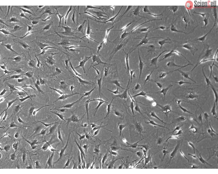 Rat Dermal Fibroblasts-adult  (RDF-a) - Phase Contrast