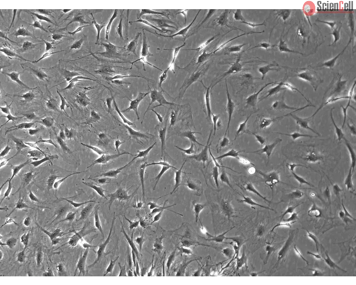 Rat Dermal Fibroblasts-adult (RDF-a) - Phase Contrast, 100x.
