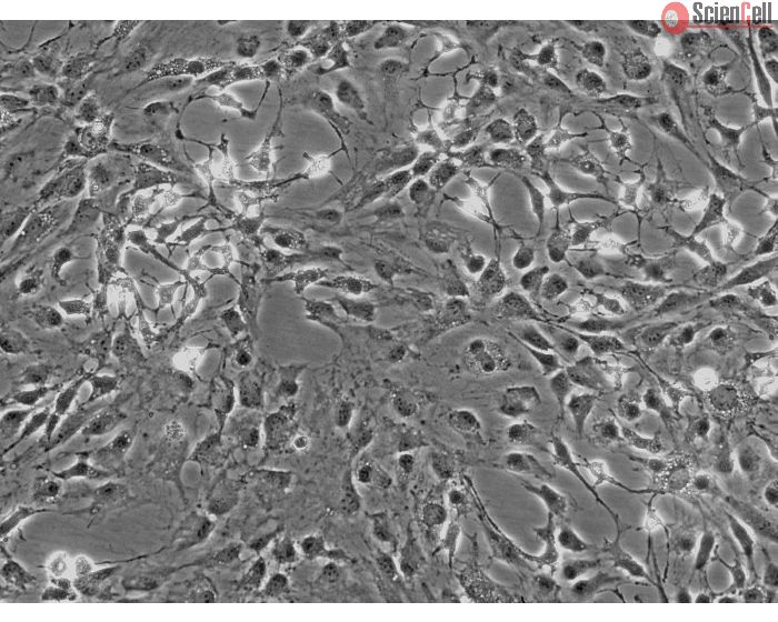 Rat Dermal Fibroblasts (RDF) - Phase contrast
