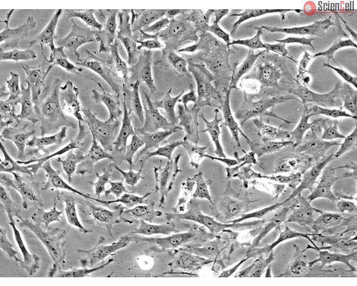 Rat Embryonic Fibroblasts (REF) - Phase contrast