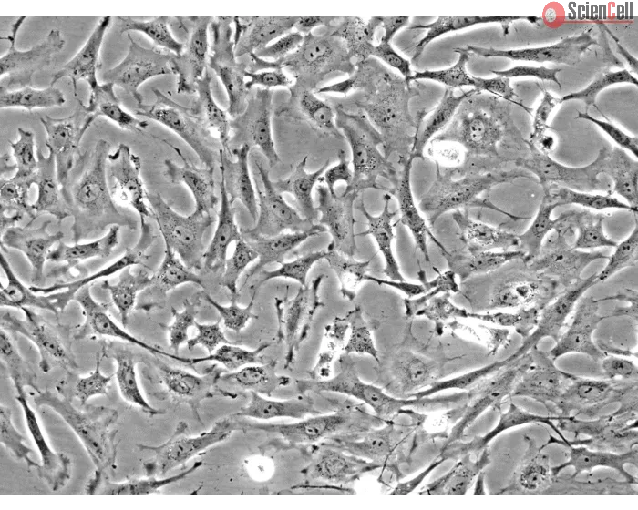 Rat Embryonic Fibroblasts (REF) - Phase contrast, 200x.
