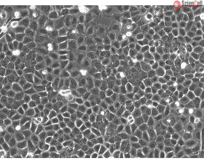 Rat Epidermal Keratinocytes (REK) – Phase Contrast, 200x
