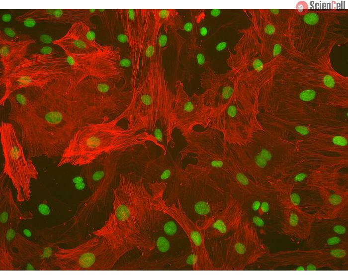 Rat Hepatic Stellate Cells (RHSteC) - Immunostaining for &alpha;-SMA
