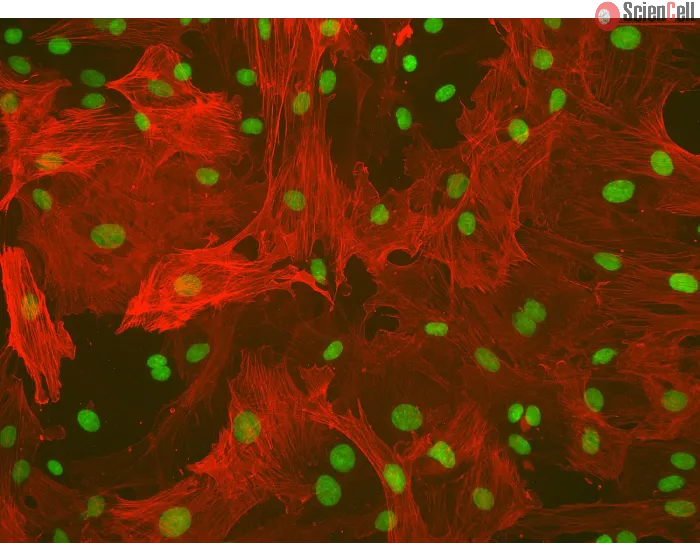 Rat Hepatic Stellate Cells (RHSteC) - Immunostaining for α-SMA, 200x.
