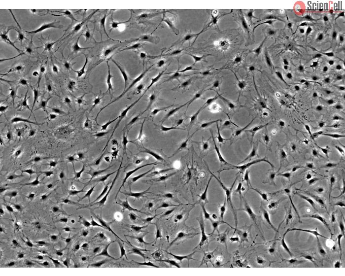 Rat Keratocytes (RK) - Phase contrast