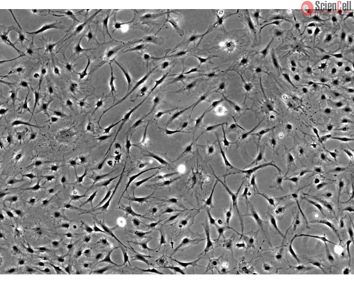 Rat Keratocytes (RK) - Phase contrast, 100x.
