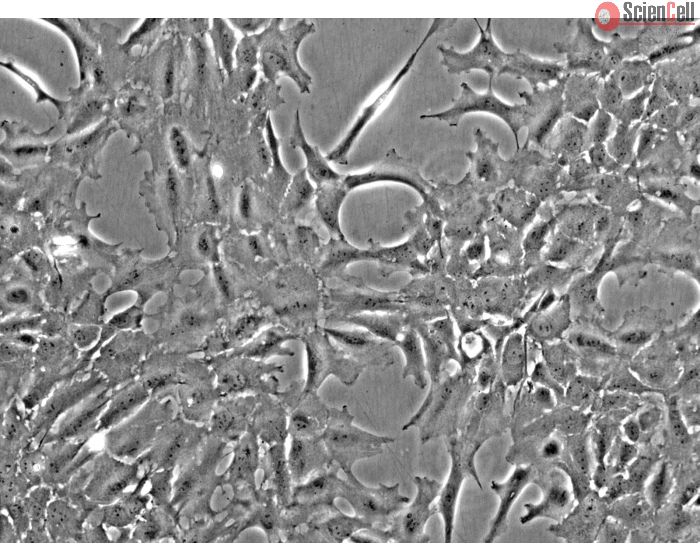 Rat Lens Epithelial Cells (RLEpiC) - Phase contrast