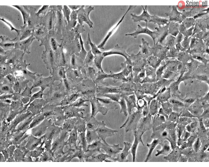 Rat Lens Epithelial Cells (RLEpiC) - Phase contrast, 200x.
