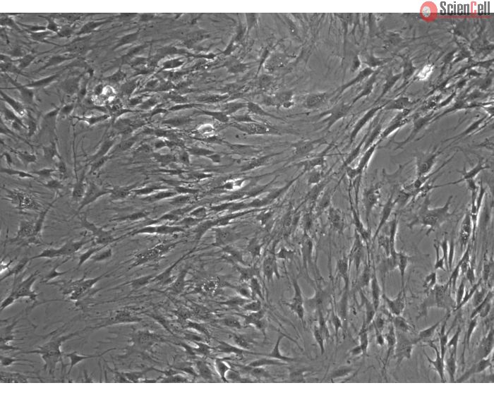 Rat Lymphatic Fibroblasts Phase Contrast