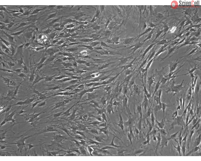 Rat Lymphatic Fibroblasts Phase Contrast