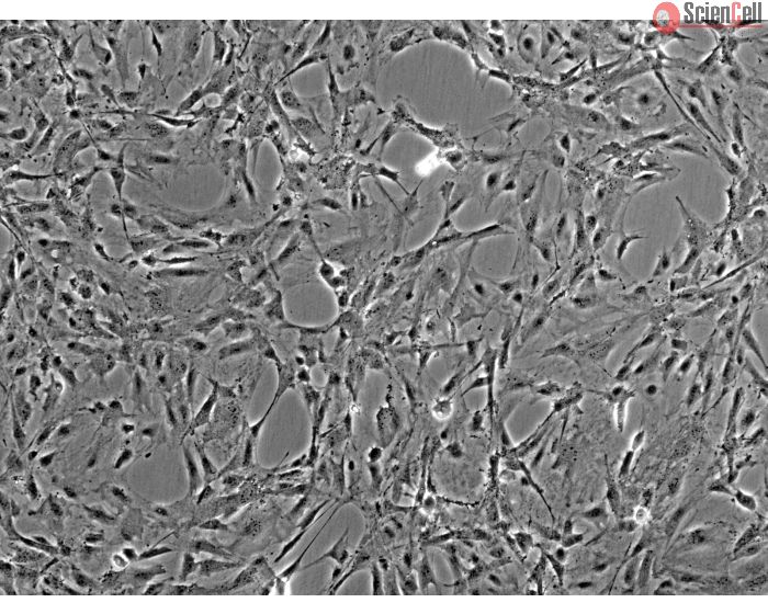 Rat Meningeal Cells (RMC) - Phase contrast