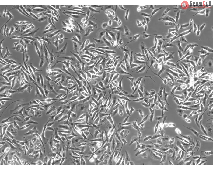 Rat Microglia (RM) - Phase contrast, 100x.
