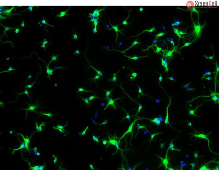 Rat Neurons-cortical