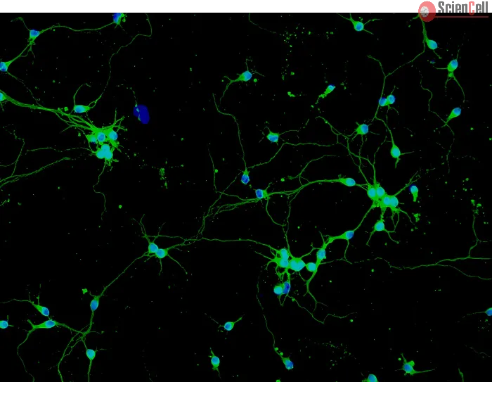 Rat Neurons-spinal cord (RN-sc) - Immunostaining for β-Tubulin III, 200x.
