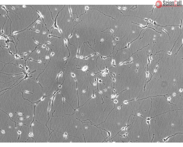 Rat Neurons-hippocampal (RN-h) - Phase contrast