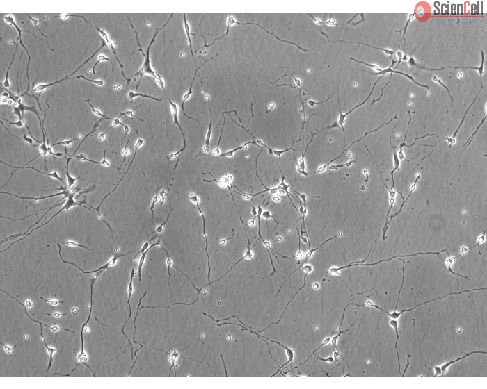 Rat Neurons-hippocampal (RN-h) - Phase contrast, 200x.
