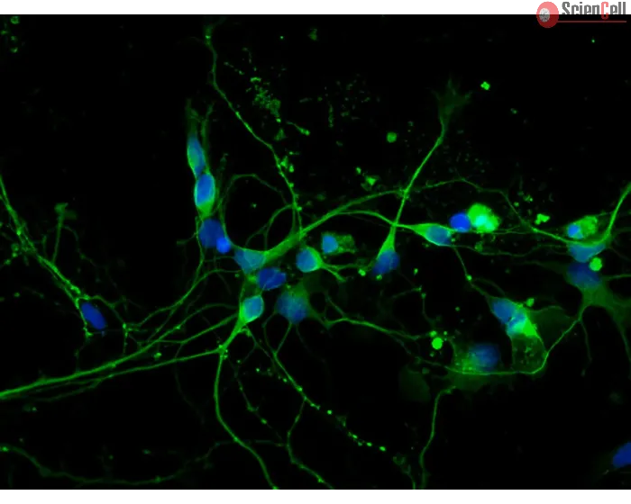 Rat Neurons-midbrain (RN-mb)- Immunostaining for β-tubulin III, 400x