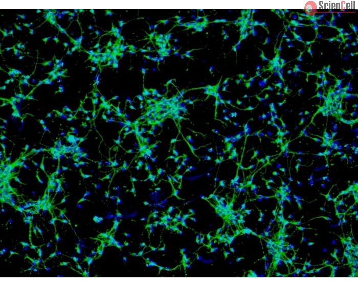 Rat Neurons-raphe (RN-r) - Immunostaining for MAP2