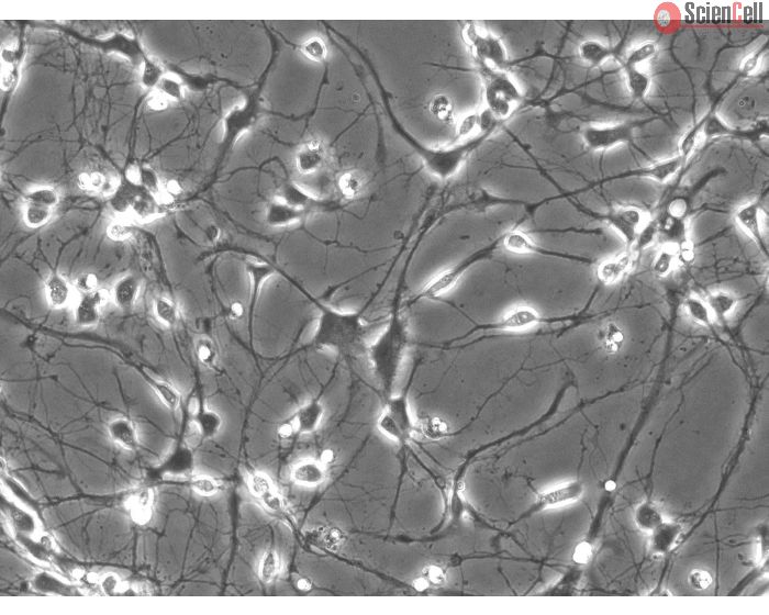 Rat Neurons-striatal (RN-s) - Phase contrast