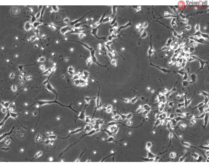 Rat Neurons-substantia nigra (RN-sn) - Phase contrast