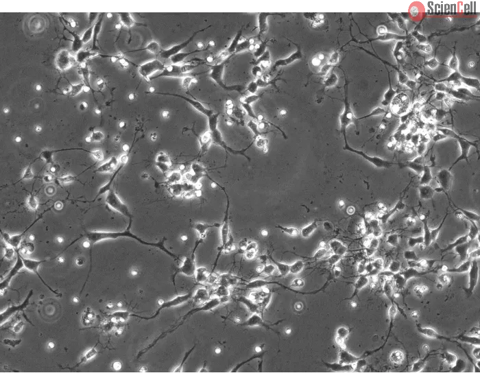 Rat Neurons-substantia nigra (RN-sn) - Phase contrast, 200x.
