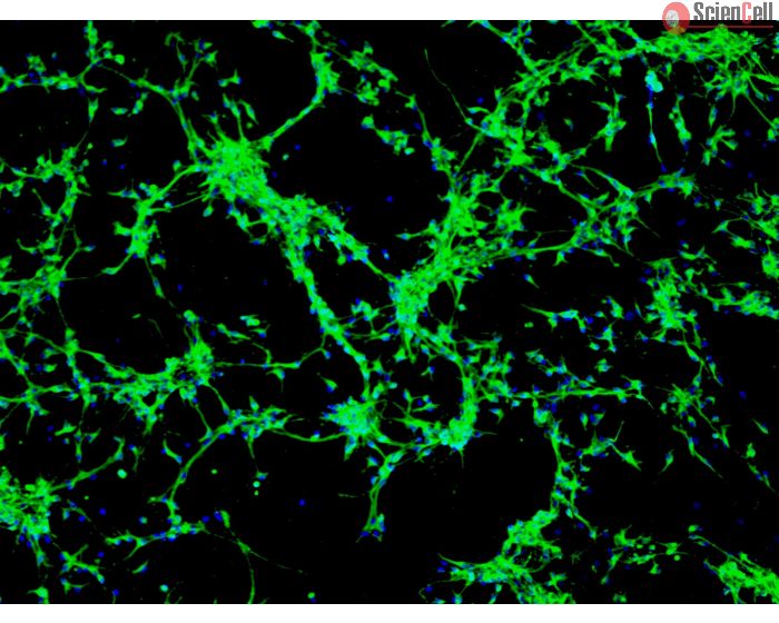 Rat Neurons-ventral spinal cord (RN-vsc) - Immunostaining for &beta;-Tubulin III
