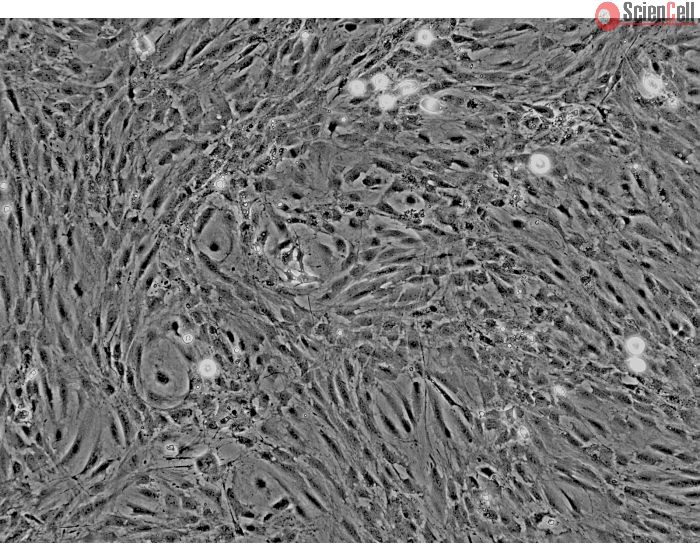 Rat Perineurial Fibroblasts (RPNF) - Phase contrast, 100x.
