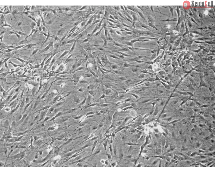 Rat Pituitary Cells (RPC) - Phase contrast, 100x.
