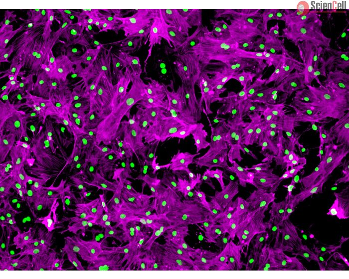 Rat Renal Mesangial Cells (RRMC) - Immunostaining for &alpha;-SMA