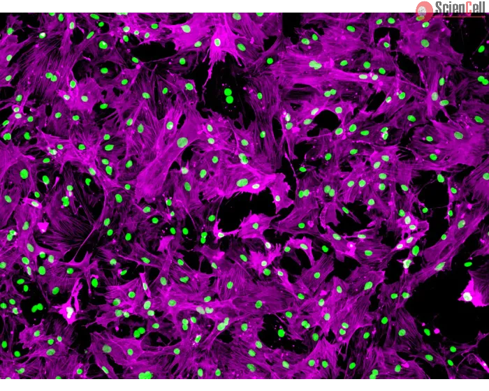 Rat Renal Mesangial Cells (RRMC) - Immunostaining for α-SMA, 100x.
