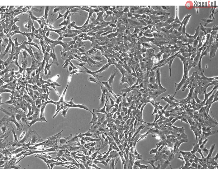 Rat Retinal Astrocytes (RA-r) – Phase Contrast, 100x.
