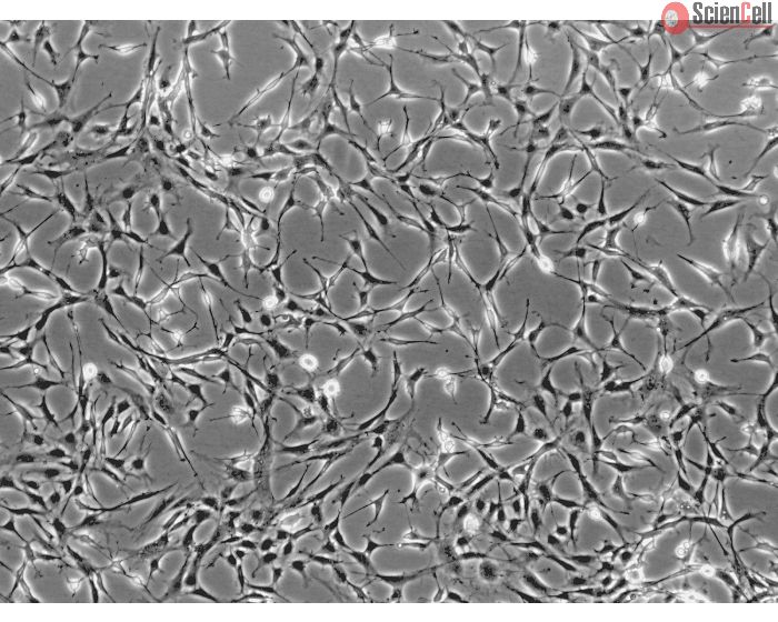 Rat Salivary Gland Fibroblasts (RSGF) - Phase contrast